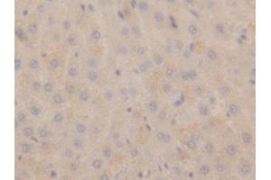 Detection of NPPA in Rat Liver Tissue using Polyclonal Antibody to Natriuretic Peptide Precursor A (NPPA) (NPPA anticorps  (AA 25-152))