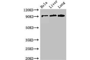 Western Blot Positive WB detected in: Hela whole cell lysate, Mouse liver tissue, Mouse lung tissue All lanes: CPT1C antibody at 2. (CPT1C anticorps  (AA 699-803))