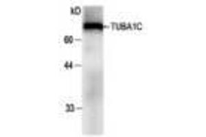 Image no. 1 for anti-Tubulin, alpha 1c (TUBA1C) antibody (ABIN791483) (TUBA1C anticorps)