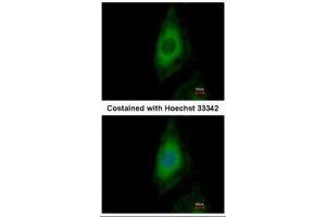 ICC/IF Image Immunofluorescence analysis of paraformaldehyde-fixed HeLa, using PP2A beta, antibody at 1:500 dilution. (PPP2CB anticorps  (Center))