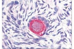 Image no. 1 for anti-delta-Like 4 (DLL4) (Internal Region) antibody (ABIN199951) (DLL4 anticorps  (Internal Region))