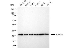Western blotting analysis using RAB7A antibody (ABIN7800103).
