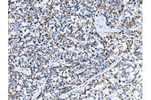 IHC analysis of TRK fused gene/TFG using anti-TRK fused gene/TFG antibody (ABIN7599839). (TFG anticorps  (AA 121-400))