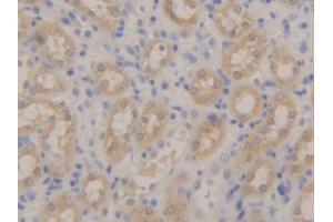 DAB staining on IHC-P; Samples: Mouse Kidney Tissue
