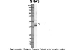 Sample Type: Nthy-ori cell lysate (50ug)Primary Dilution: 1:1000Secondary Antibody: anti-rabbit HRPSecondary Dilution: 1:2000Image Submitted By: Anonymous (GNAS anticorps  (N-Term))