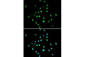 Immunofluorescence analysis of A549 cell using HDAC1 antibody. (HDAC1 anticorps  (AA 393-482))