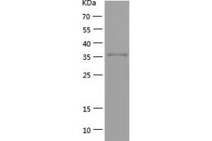 Western Blotting (WB) image for Tumor Necrosis Factor Receptor Superfamily, Member 8 (TNFRSF8) (AA 19-379) protein (His-IF2DI Tag) (ABIN7125556)