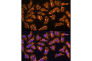 Immunofluorescence analysis of U2OS using SPRR3 antibody (ABIN6130714, ABIN6148386, ABIN6148387 and ABIN6215609) at dilution of 1:100 (40x lens).