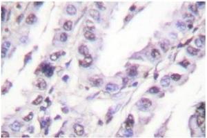 Image no. 1 for anti-X-Ray Repair Complementing Defective Repair in Chinese Hamster Cells 5 (Double-Strand-Break Rejoining) (XRCC5) antibody (ABIN271897) (XRCC5 anticorps)