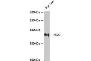 Western blot analysis of extracts of rat liver, using NOS1 antibody (ABIN3022008, ABIN3022009, ABIN3022010 and ABIN6218566) at 1:2000 dilution. (NOS1 anticorps  (AA 1-180))