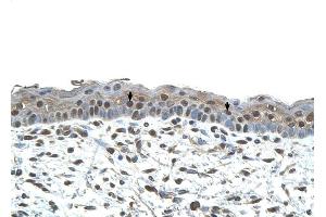 CENPA antibody was used for immunohistochemistry at a concentration of 4-8 ug/ml to stain Squamous epithelial cells (arrows) in Human Skin.