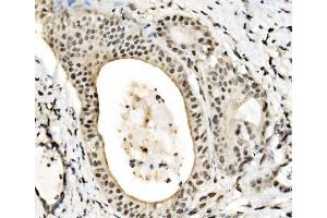 IHC analysis of JUNB using anti-JUNB antibody (ABIN7603223). (JunB anticorps  (N-Term))