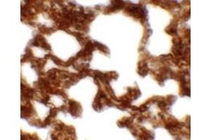 Immunohistochemistry of NETO1 in rat lung tissue with NETO1 antibody at 2. (NETO1 anticorps  (C-Term))