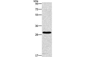 Western blot analysis of Hela cell, using BCL10 Polyclonal Antibody at dilution of 1:950 (BCL10 anticorps)