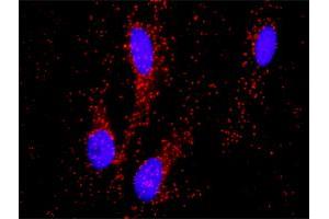 Proximity Ligation Analysis of protein-protein interactions between PITX2 and CTNNB1.