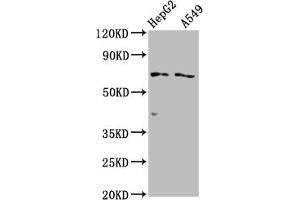 Western Blot Positive WB detected in: HepG2 whole cell lysate, A549 whole cell lysate All lanes: SLCO1B1 antibody at 1:2000 Secondary Goat polyclonal to rabbit IgG at 1/50000 dilution Predicted band size: 77 kDa Observed band size: 77 kDa (SLCO1B1 anticorps  (AA 426-537))
