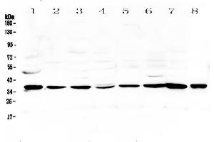 Western blot analysis of Thrombopoietin using anti-Thrombopoietin antibody . (Thrombopoietin anticorps  (AA 27-259))