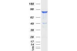 Validation with Western Blot