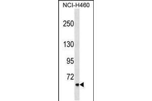 Western blot analysis in NCI-H460 cell line lysates (35ug/lane). (CLCNKA anticorps  (N-Term))