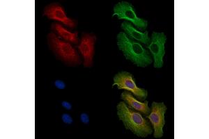 ABIN6256556 and ABIN6267493 staining H2O2 treated Hela cells by IF/ICC. (MEK2 anticorps  (pThr394))