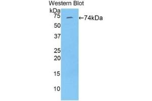 WB of Protein Standard: different control antibodies against Highly purified E. (FBLN4 Kit ELISA)