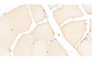 Detection of PARK7 in Human Skeletal muscle Tissue using Polyclonal Antibody to Parkinson Disease Protein 7 (PARK7) (PARK7/DJ1 anticorps  (AA 1-189))