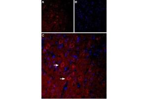 Expression of Serotonin receptor 3A in rat brain - Immunohistochemical staining of rat parietal cortex using Anti-5HT3A Receptor (HTR3A) Antibody (ABIN7043621, ABIN7045283 and ABIN7045284), (1:400), (red).