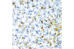 Immunohistochemistry of paraffin-embedded mouse kidney using TAPBP Antibody (ABIN6132745, ABIN6148848, ABIN6148850 and ABIN6219122) at dilution of 1:200 (40x lens).