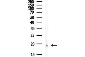 anti-Zinc Finger Protein 580 (ZNF580) antibody