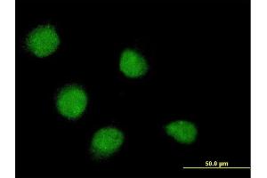 Immunofluorescence of monoclonal antibody to SSX4 on HeLa cell. (SSX4 anticorps  (AA 91-188))