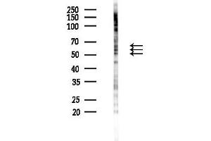 Western blot analysis of lysates from K562 cells(UV 30 min treatment), using Phospho-Smad2 (Ser250) Antibody at 1/1000 dilution.