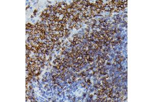 Immunohistochemistry of paraffin-embedded rat spleen using Apolipoprotein C3 antibody (ABIN7265641) at dilution of 1:100 (40x lens).