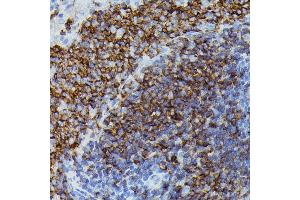 Immunohistochemistry of paraffin-embedded rat spleen using Apolipoprotein C3 antibody (ABIN7265641) at dilution of 1:100 (40x lens). (APOC3 anticorps  (AA 1-99))