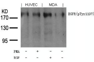 Image no. 1 for anti-Epidermal Growth Factor Receptor (EGFR) (pTyr1197) antibody (ABIN401613) (EGFR anticorps  (pTyr1197))