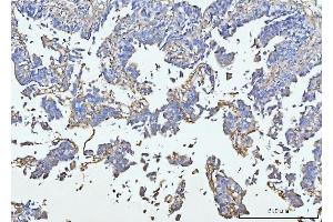 IHC analysis of COL6A1 using anti-COL6A1 antibody (ABIN7600515).