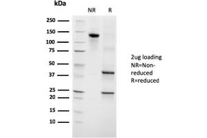 SDS-PAGE Analysis Purified Growth Hormone Mouse Monoclonal Antibody (GH/3155). (Growth Hormone 1 anticorps)