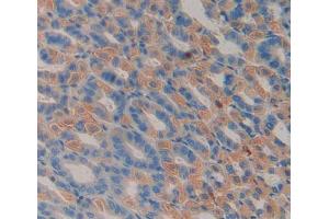 Used in DAB staining on fromalin fixed paraffin- embedded stomach tissue