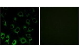 Immunofluorescence analysis of HuvEc cells, using RPS4X Antibody. (RPS4X anticorps  (AA 81-130))