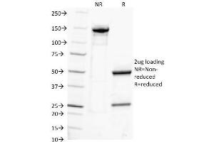 SDS-PAGE Analysis Purified IgG Monoclonal Antibody (IG217). (IGHG anticorps)