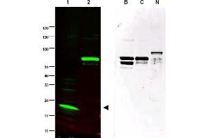 Image no. 1 for anti-SPANX Family, Member C (SPANXC) (AA 31-47) antibody (ABIN401329) (SPANXC anticorps  (AA 31-47))