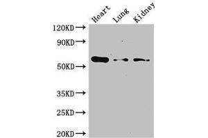 Western Blot Positive WB detected in: Mouse heart tissue, Mouse lung tissue, Mouse kidney tissue All lanes: Gcgr antibody at 3 μg/mL Secondary Goat polyclonal to rabbit IgG at 1/50000 dilution Predicted band size: 55 kDa Observed band size: 55 kDa (Glucagon Receptor anticorps  (AA 26-136))