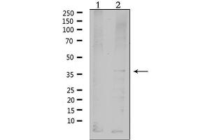 Western blot analysis of extracts from HepG2, using MC4R Antibody. (MC4R anticorps  (C-Term))