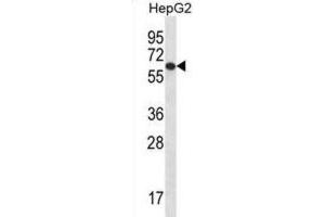 Western Blotting (WB) image for anti-TBC1 Domain Family, Member 22A (TBC1D22A) antibody (ABIN2996989) (TBC1D22A anticorps)