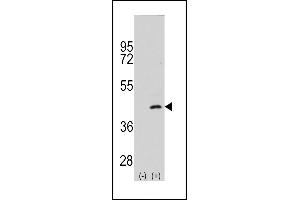 Western blot analysis of P2K4 (arrow) using rabbit polyclonal P2K4 Antibody  (ABIN392418 and ABIN2842027). (MAP2K4 anticorps  (AA 235-264))