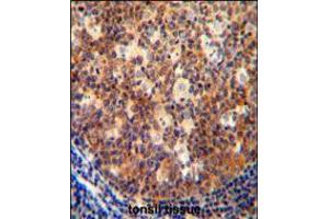 IL12B antibody immunohistochemistry analysis in formalin fixed and paraffin embedded human tonsil tissue followed by peroxidase conjugation of the secondary antibody and DAB staining. (IL12B anticorps  (C-Term))