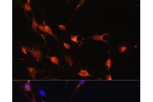 Immunofluorescence analysis of C6 cells using RAB11A Polyclonal Antibody at dilution of 1:100. (RAB11A anticorps)