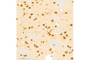 Immunohistochemistry of paraffin embedded rat brain using HES3 (ABIN7074159) at dilution of 1:1000 (400x lens) (HES3 anticorps)