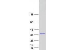 Validation with Western Blot