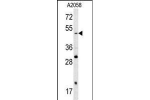 Western blot analysis of SOX4 antibody (N-term) (ABIN388786 and ABIN2839119) in  cell line lysates (35 μg/lane). (SOX4 anticorps  (N-Term))