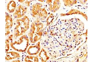 IHC image of ABIN7146077 diluted at 1:600 and staining in paraffin-embedded human kidney tissue performed on a Leica BondTM system. (CLEC4E anticorps  (AA 41-219))